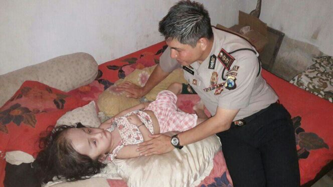 
					Kapolresta Probolinggo, AKBP Alfian Nurrizal saat mengunjungi bocah penderita Hidrosefalus Rosalia, beberapa waktu lalu.