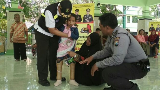 
					Almira Sabina Putri (7), mendapatkan bantuan kaki palsu dari Polres Probolinggo, Jum'at (29/9/2017).