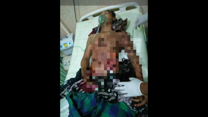 
					Mengenaskan, Kuli Bangunan di Legundi Dibacok OTK