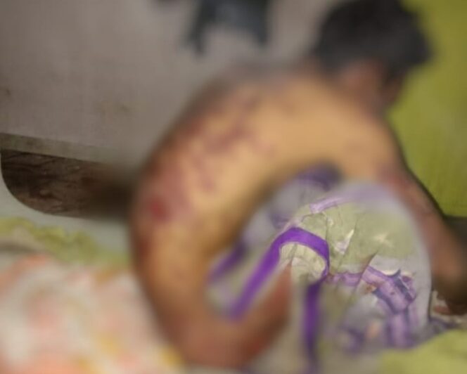 
					Nestapa Jumari, Terserang Penyakit Aneh, Terlantar di Perantauan