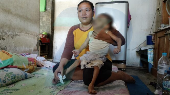 
					Alami Lumpuh Otak, Balita di Kademangan ini Butuh Uluran Tangan