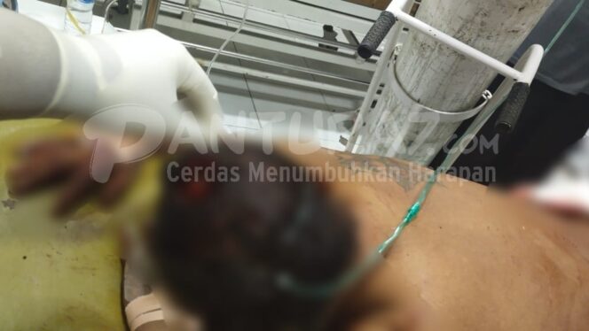 
					Petani di Lekok Dibacok, Pelaku Kabur