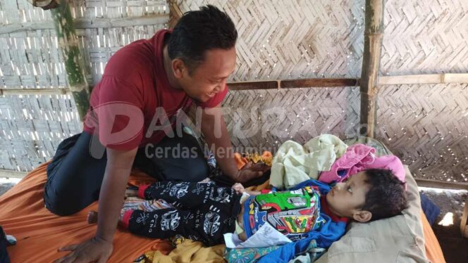 
					Anak Pemulung di Paiton Didera Busung Lapar