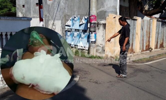 
					Dibuntuti lalu Dibacok, Tangan Warga Jorongan Nyaris Putus