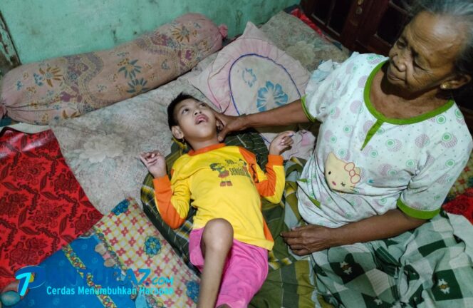 
					Rifka Dina Aulia, Bocah Yatim-piatu Penderita Gizi Buruk ini Butuh Bantuan